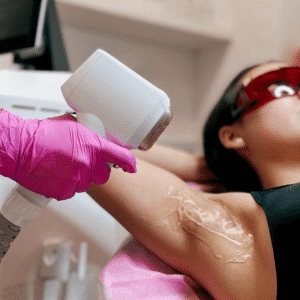 Depilacja laserowa – damska